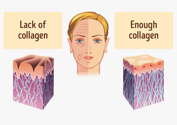 Collagen__1__fcff807167ec44cebda8e5dad5cb9f4e