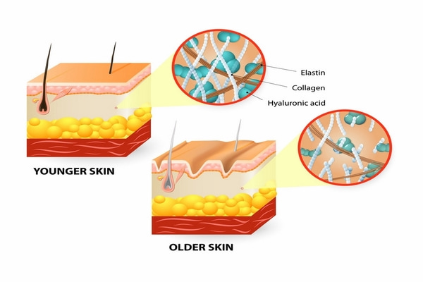 Elastin_la_gi_collagen_va_elastin_co_vai_tro_gi_trong_da__1__268c2a69d0e84683b19a078645c644a5