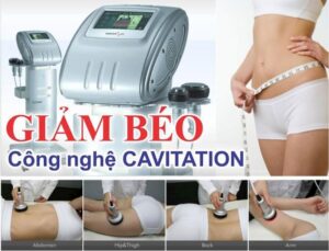 GIẢM BÉO CAVITATION