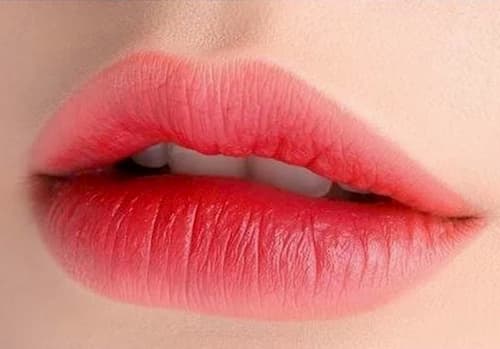 phun môi collagen tại Viện thẩm mỹ Liên Anh