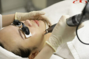Tri_nam_bang_laser_bao_nhieu_tien_laser_dieu_tri_nam_hieu_qua__1__d01a36d3a4514ba7a8aea7441a9b178f
