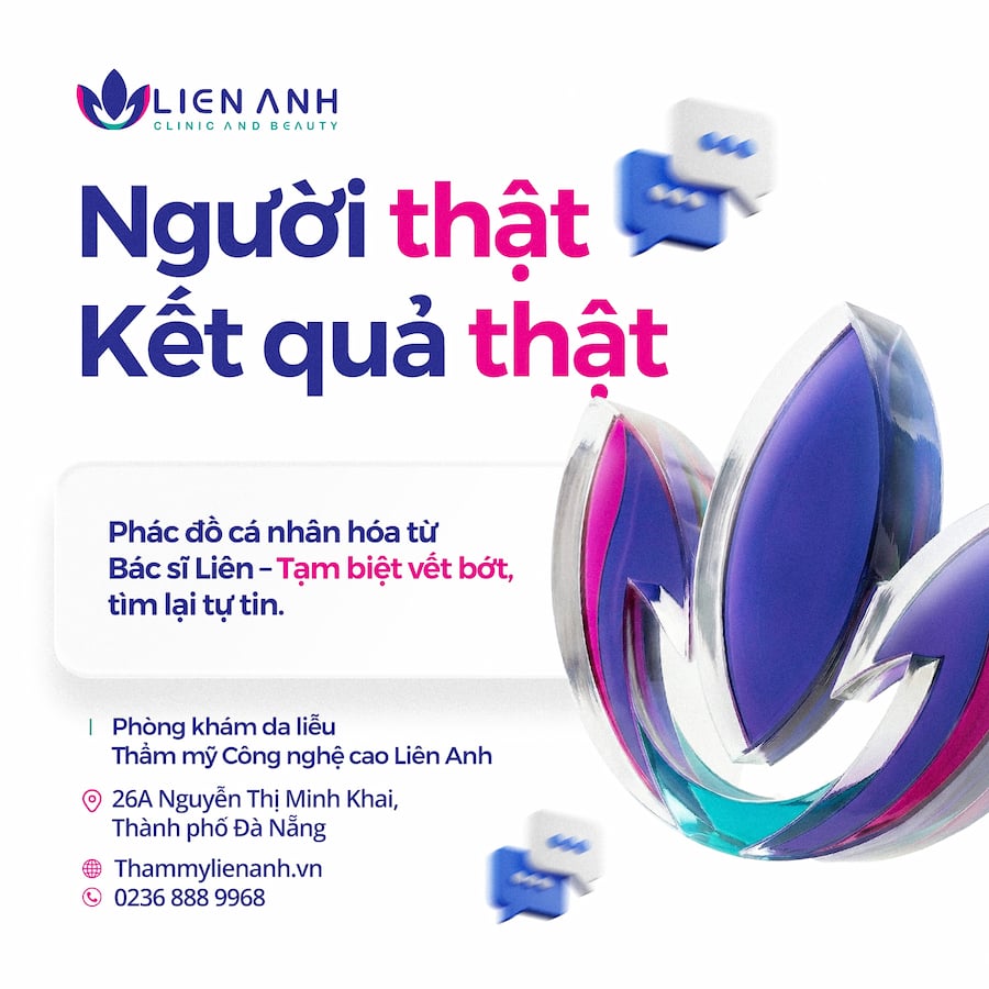 Khách hàng D.L điều trị bớt sắc tố